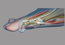 Common toe Deformities