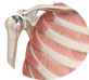 Shoulder Joint Replacement